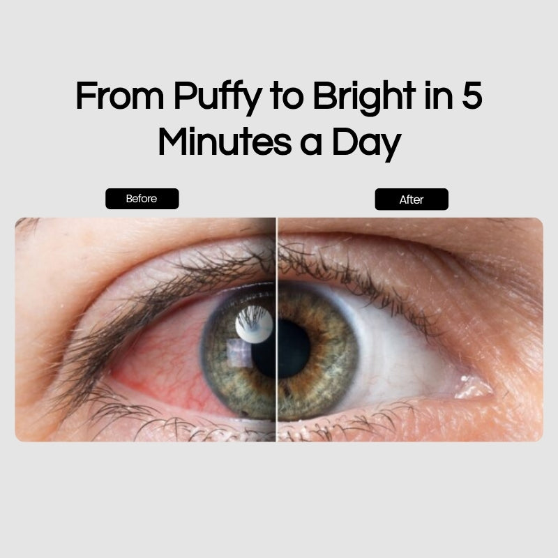 Bryft Eye Revival Glasses®