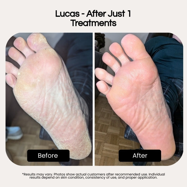 Bryft Heel Therapy+