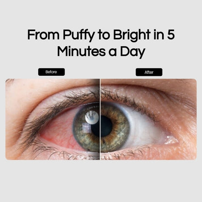 Bryft Eye Revival Glasses®