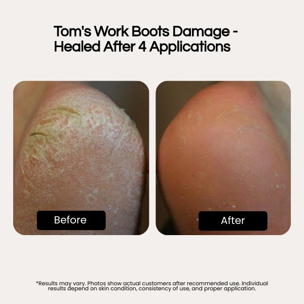 Bryft Heel Therapy+